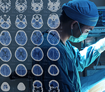 CT、MRI、立体定向等神经外科领域的科技发展