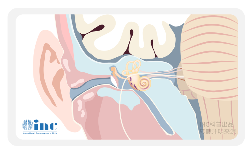耳鸣3个月检查是“听神经瘤”！专家：及时手术可阻止癌变
