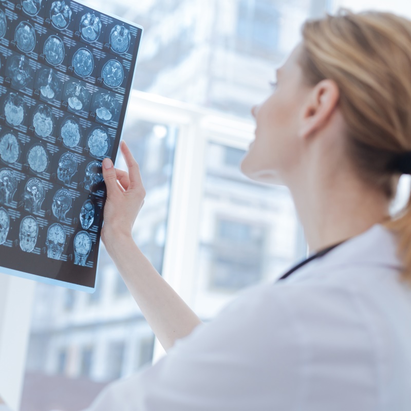 脑干手术期间的运动诱发电位（MEP）可保持皮质脊髓功能