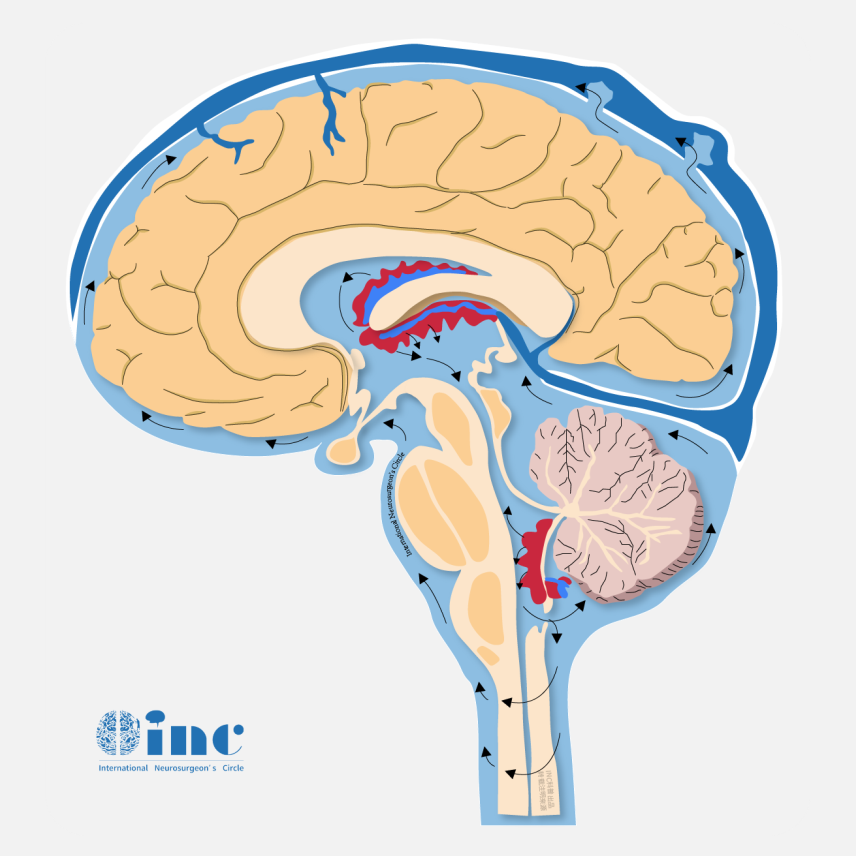 <a href='/bingzhong/chuitiliu/' target='_blank'><u>垂体瘤</u></a>