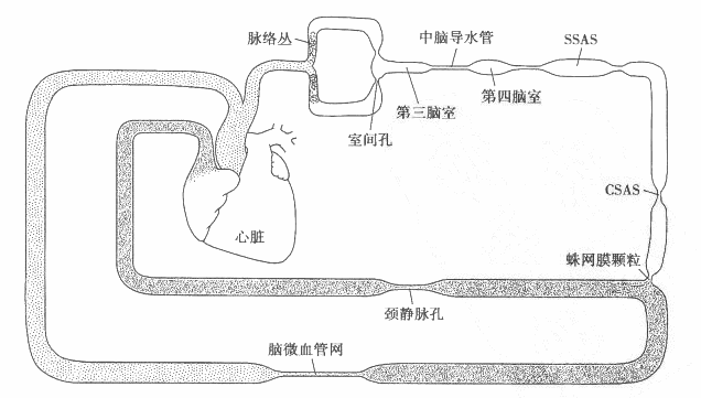 脑积水