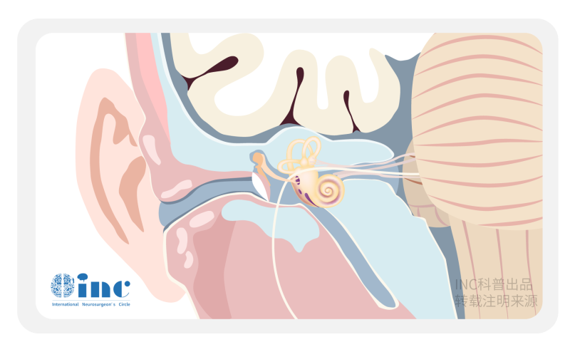 听神经瘤手术