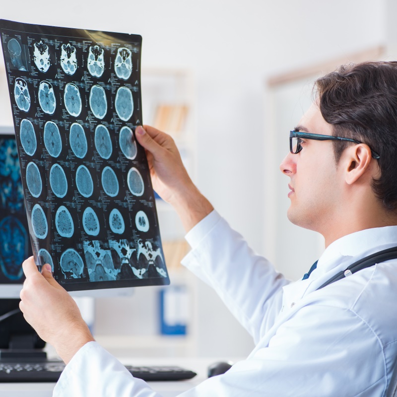 脑膜瘤的典型CT表现是什么？脑膜瘤MRI表现有哪些？