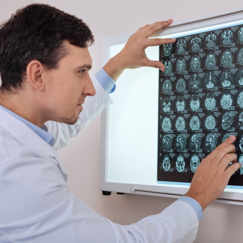 脑海绵状血管瘤为什么要手术全切呢？