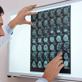 脑膜瘤严重吗?一文解读脑膜瘤前沿治疗进展