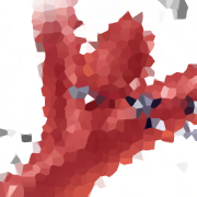 脑动脉瘤手术成功率多少？三种主要手术方法解读