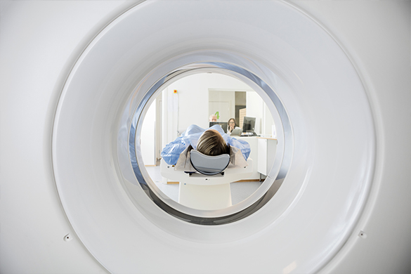 术中磁共振（iMRI）在复发性垂体瘤神经内镜手术中的作用