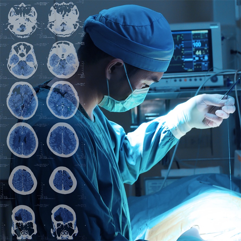 神经外科手术技术之幕上开颅术