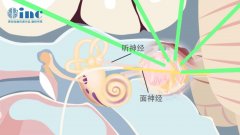 听神经瘤面瘫的九大必知问题【术中篇】