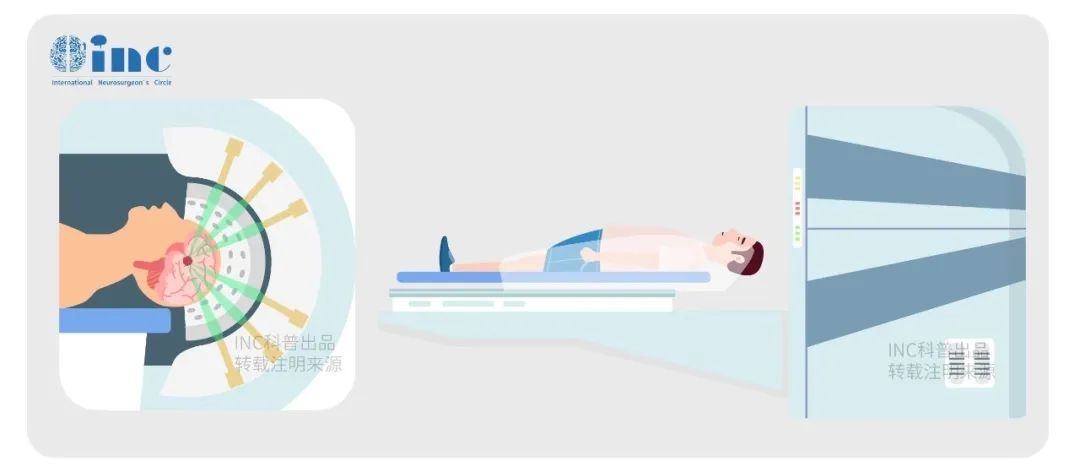 颅咽管瘤到底能不能全切