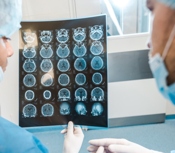 脑膜瘤治疗方案