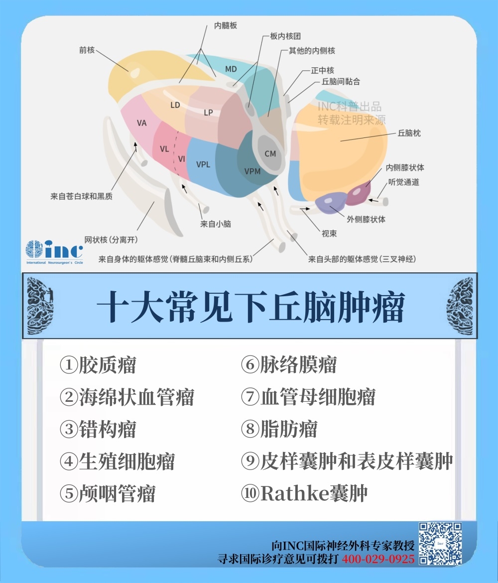 丘脑胶质瘤能治愈吗？