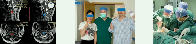 INC成功手术案例之脊髓髓内肿瘤可能瘫痪的他，全切术后没有复发、行走自如！