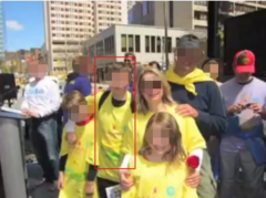 髓母细胞瘤治愈案例，髓母细胞瘤有治好的吗?