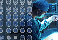 垂体瘤能活多久?垂体瘤手术完整切除的意义