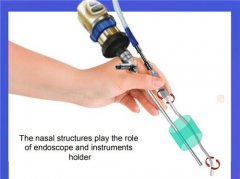 出国看病：垂体瘤要开颅吗？国外怎么治疗？