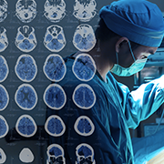 一文读懂深部脑刺激DBS治疗帕金森