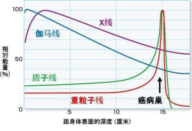 出国治疗：质子治疗星型细胞脑胶质瘤