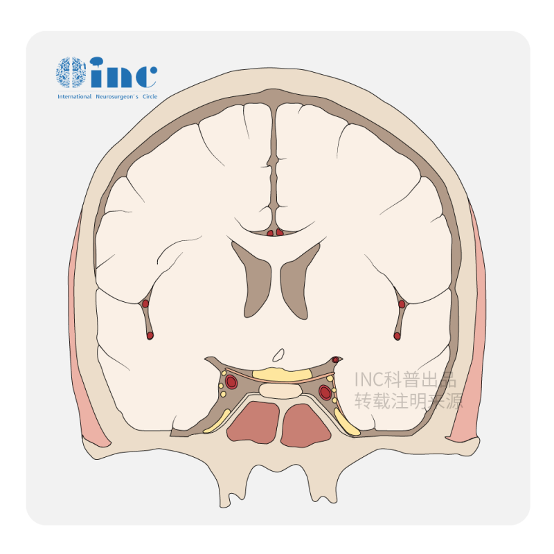 脑垂体瘤的视力影响研究