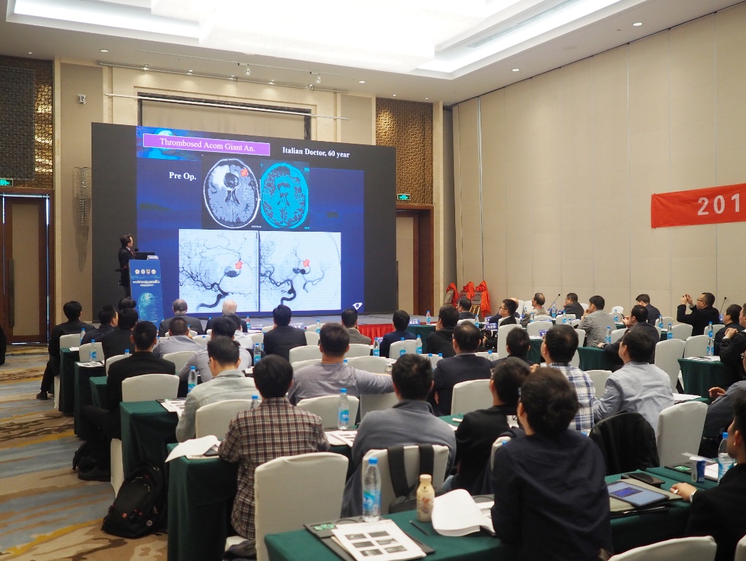 福岛孝德解析脑动脉瘤前沿手术治疗
