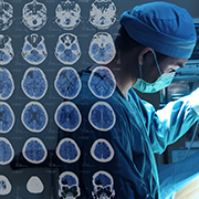 脑动静脉血管畸形日常要注意什么