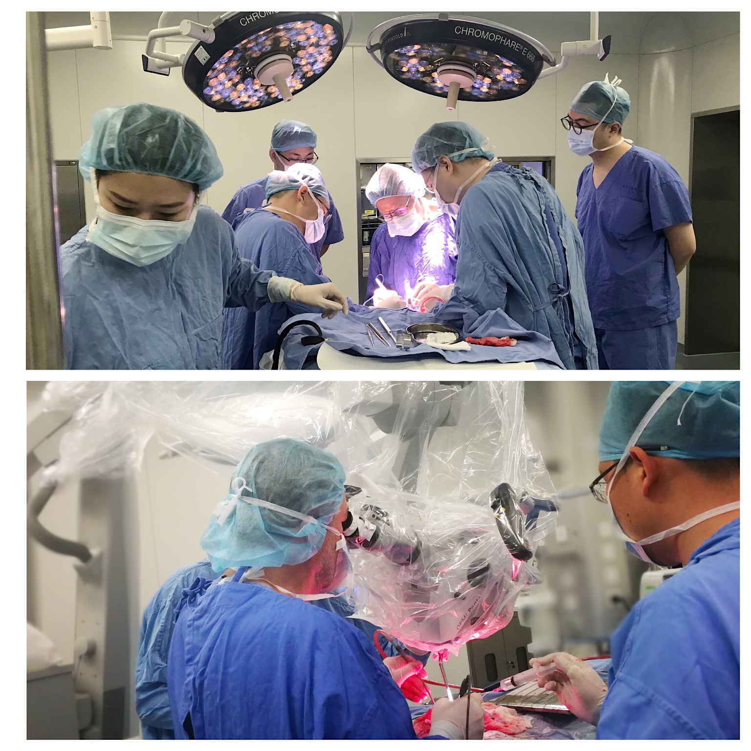 INC巴特朗菲教授国内手术实拍——基底节区脑瘤案例