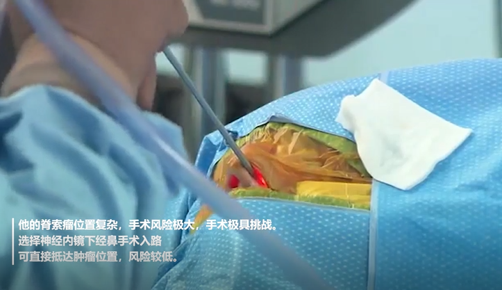 Froelich教授注意保护窦里的神经血管