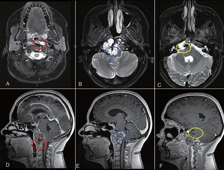 Froelich教授提供的治疗策略