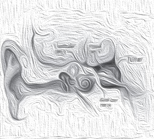 【听神经瘤】听神经鞘瘤切除是不是大手术？