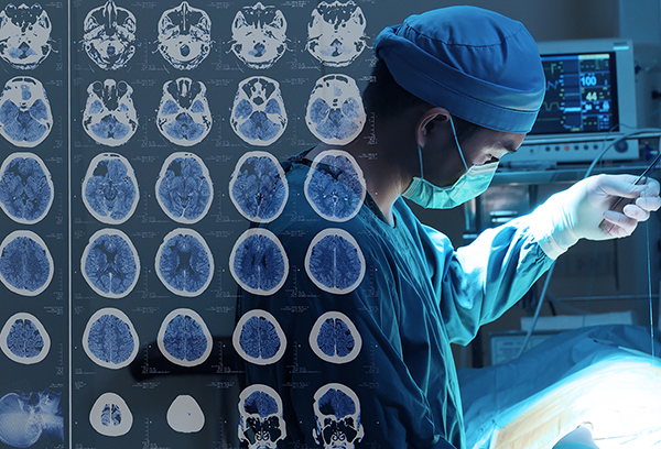 使用术中MRI进行脑外科手术：术中MRI对神经外科手术有何帮助？