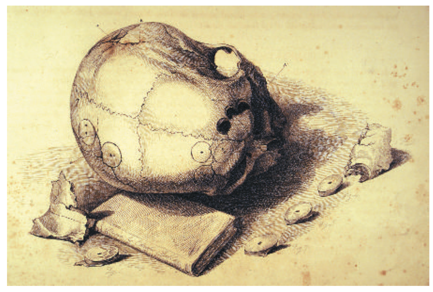 早期关于头骨"顺利"区域定义的插图