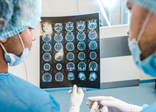 女性脑膜瘤的早期症状