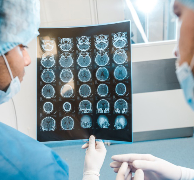 肢端肥大症不容忽视：原是垂体瘤惹的祸