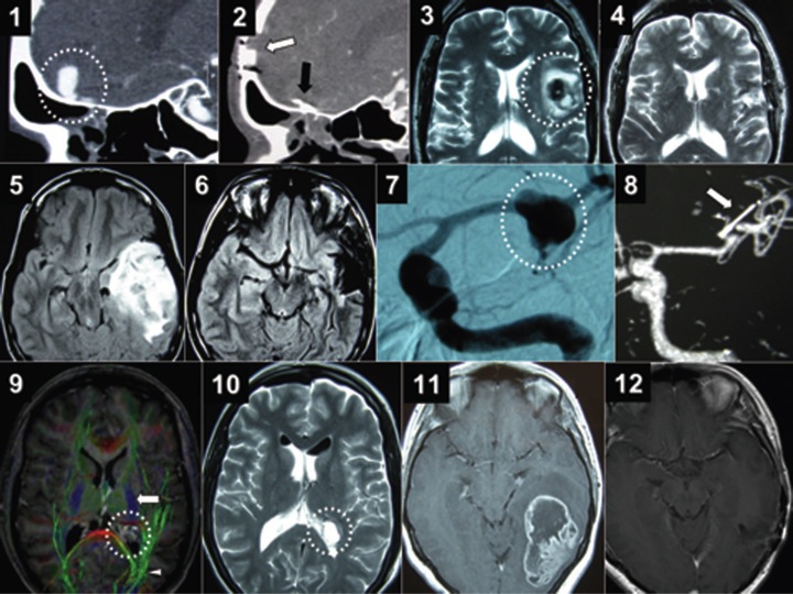 开颅手术国际教授