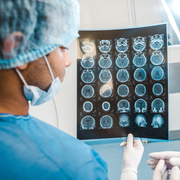 出国治疗脑瘤注意事项多，同时这些坑要避免