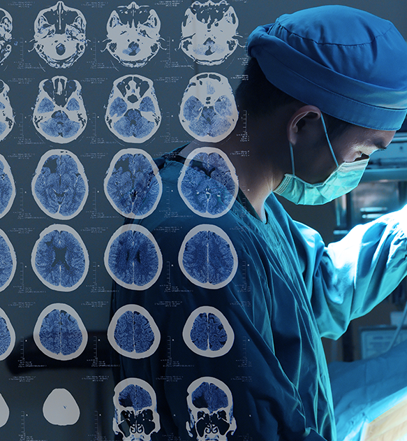 耳鸣是听神经瘤的可能性大吗?如何排除听神经瘤?