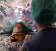 脑瘤开颅手术时拉小提琴，术中唤醒手术成功保留运动神经