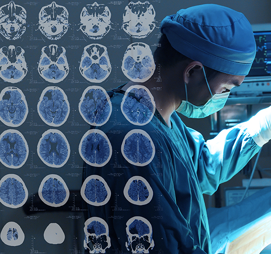 垂体瘤出国看病前沿技术：神经内镜经鼻-蝶窦切除术