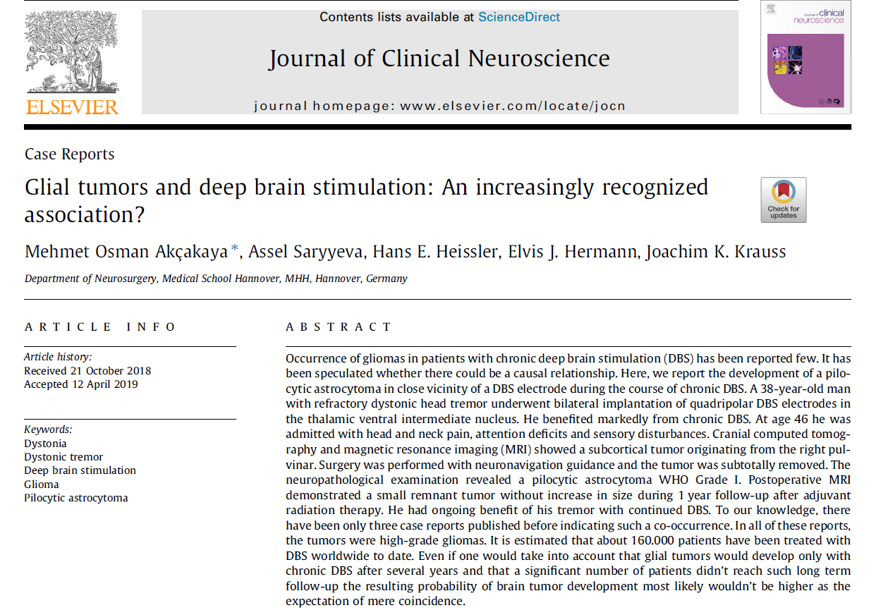 <a href='/bingzhong/jiaozhiliu/' target='_blank'><u>胶质瘤</u></a>