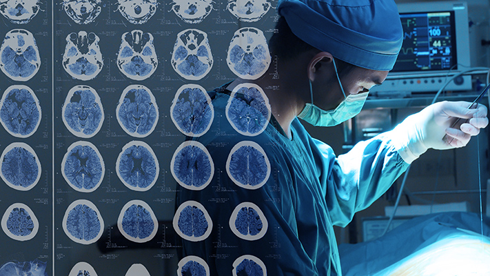 脑肿瘤质子治疗