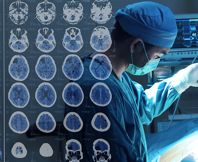 左枕叶胶质瘤严重吗？