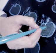 得了脑肿瘤怎么办？