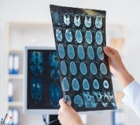 脑肿瘤会遗传吗？