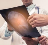 脑部胶质瘤早期有什么症状？