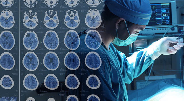 肌张力障碍，脑深部刺激术