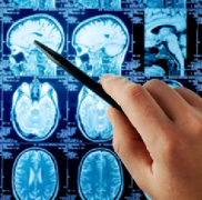 为什么胶质母细胞瘤在手术后经常重新生长？