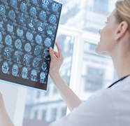 术中神经电生理监测在脊髓内肿瘤切除手术中有什么作用？