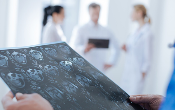 儿童低级别脑部胶质瘤