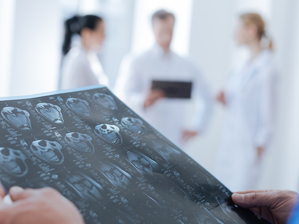 7岁患儿因脑瘤频发癫痫，LITT治疗避免2次开颅手术和生长发育损害