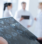 胶质母细胞瘤复发的治疗方案与应对